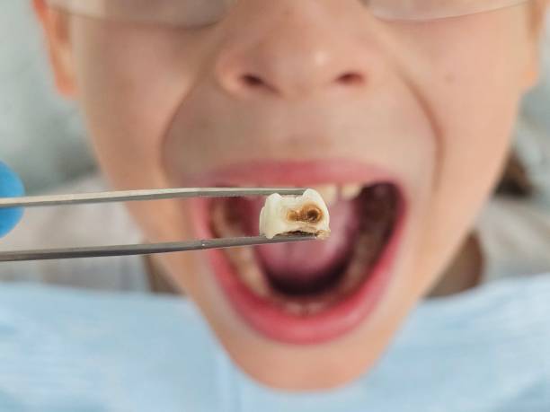 Best Emergency Pediatric Dental Care in Bean Station, TN